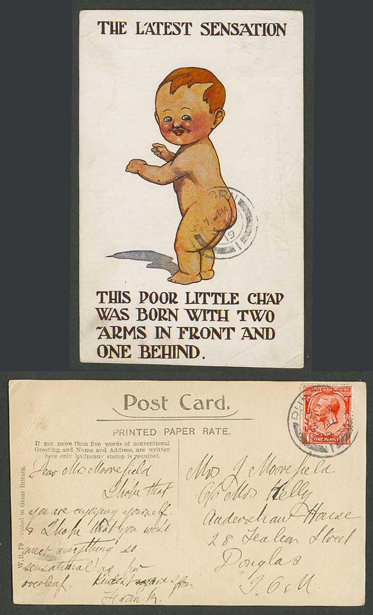 Latest Sensation Poor Little Chap Born with 2 Arms One Behind 1919 Old Postcard