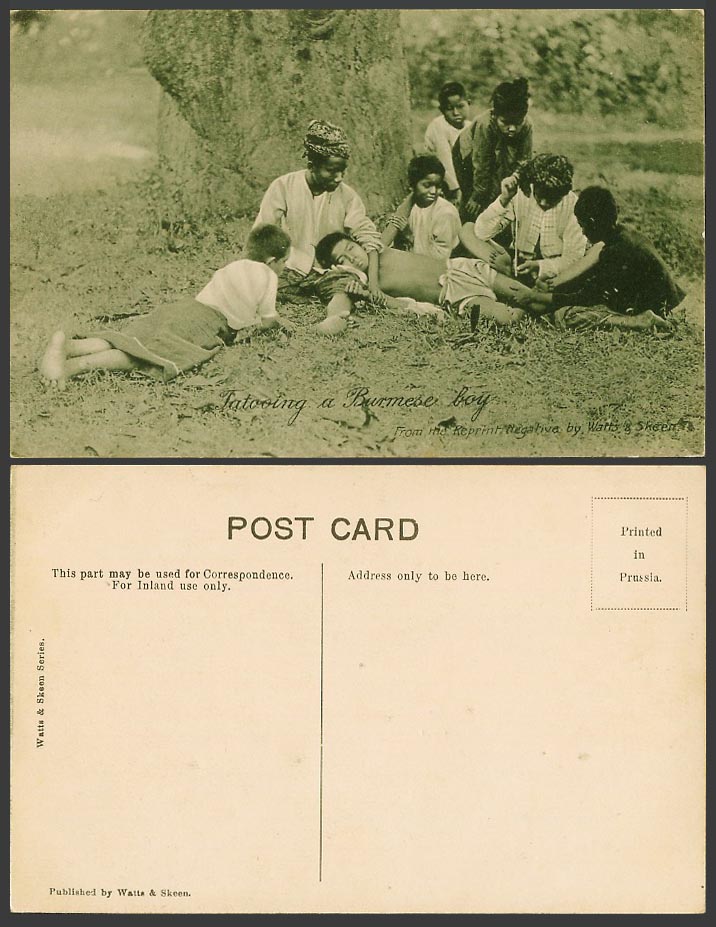 Burma Old Postcard Tatoo Tatooing a Burmese Boy on Leg, Native Men Children Boys